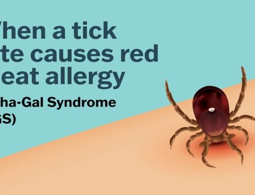 Living with Alpha-Gal: From Tick Bites to Medicine Bottles